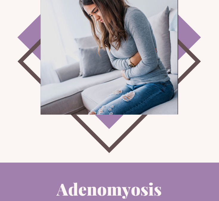 Adenomyosis, Endo’s Wicked Sister
