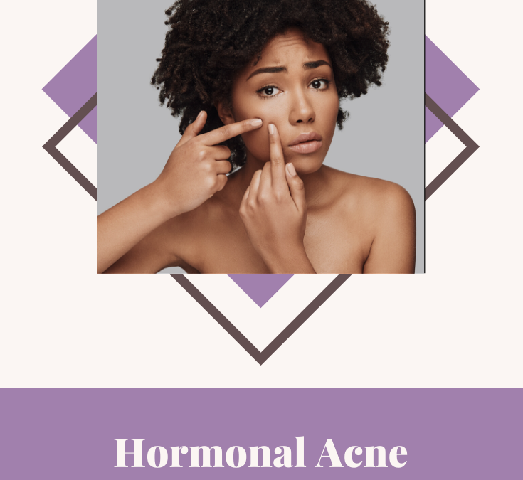 Struggling with Hormonal Acne? Here’s Why